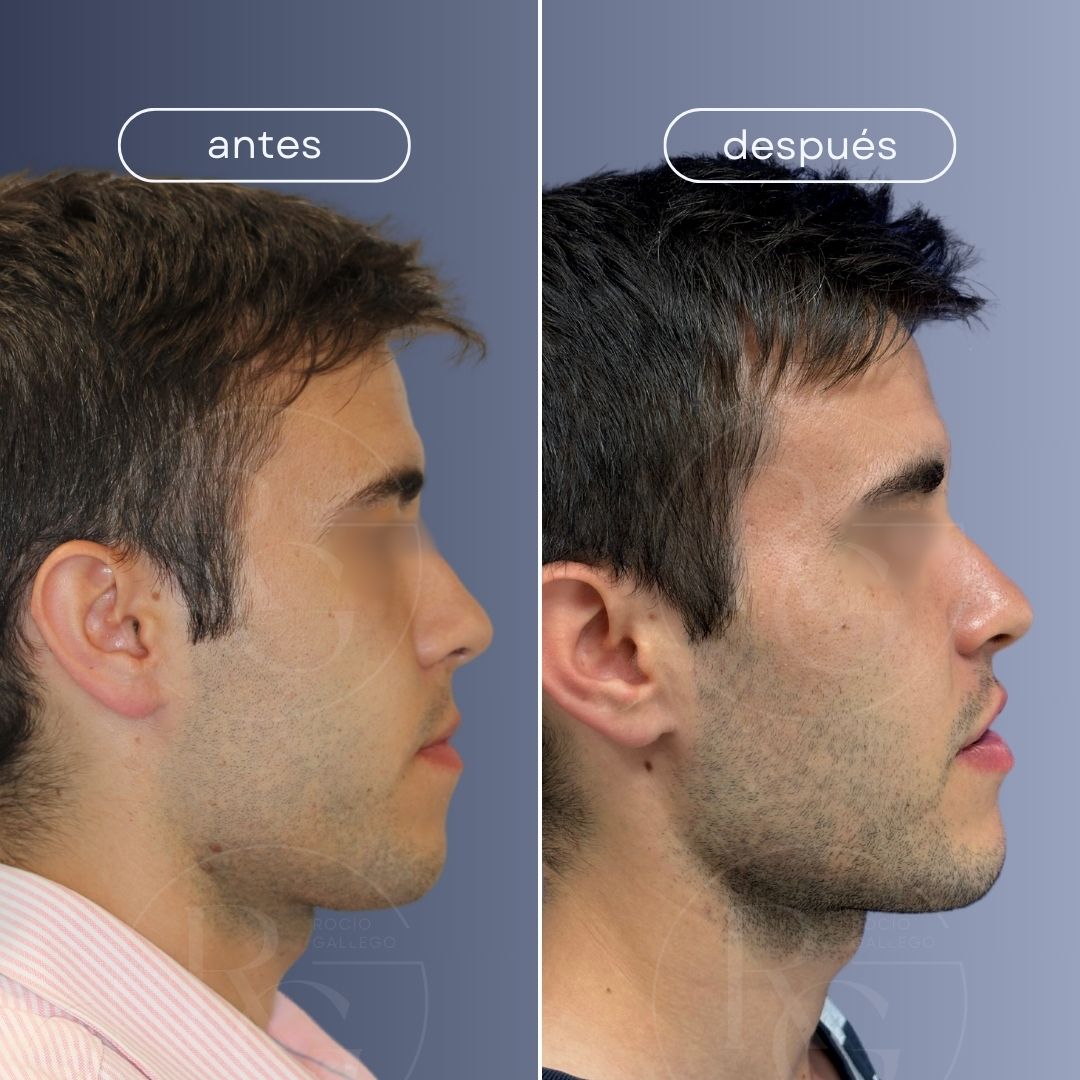 ortognatica zaragoza