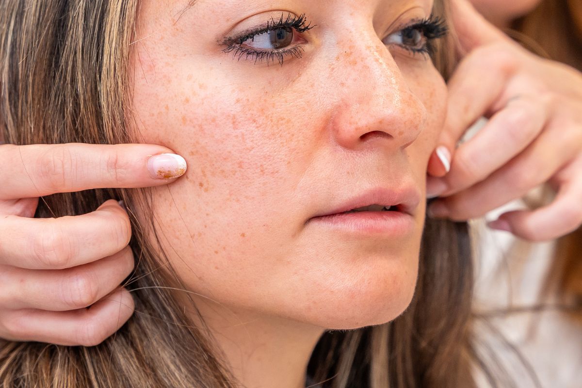 armonizacion facial en zaragoza