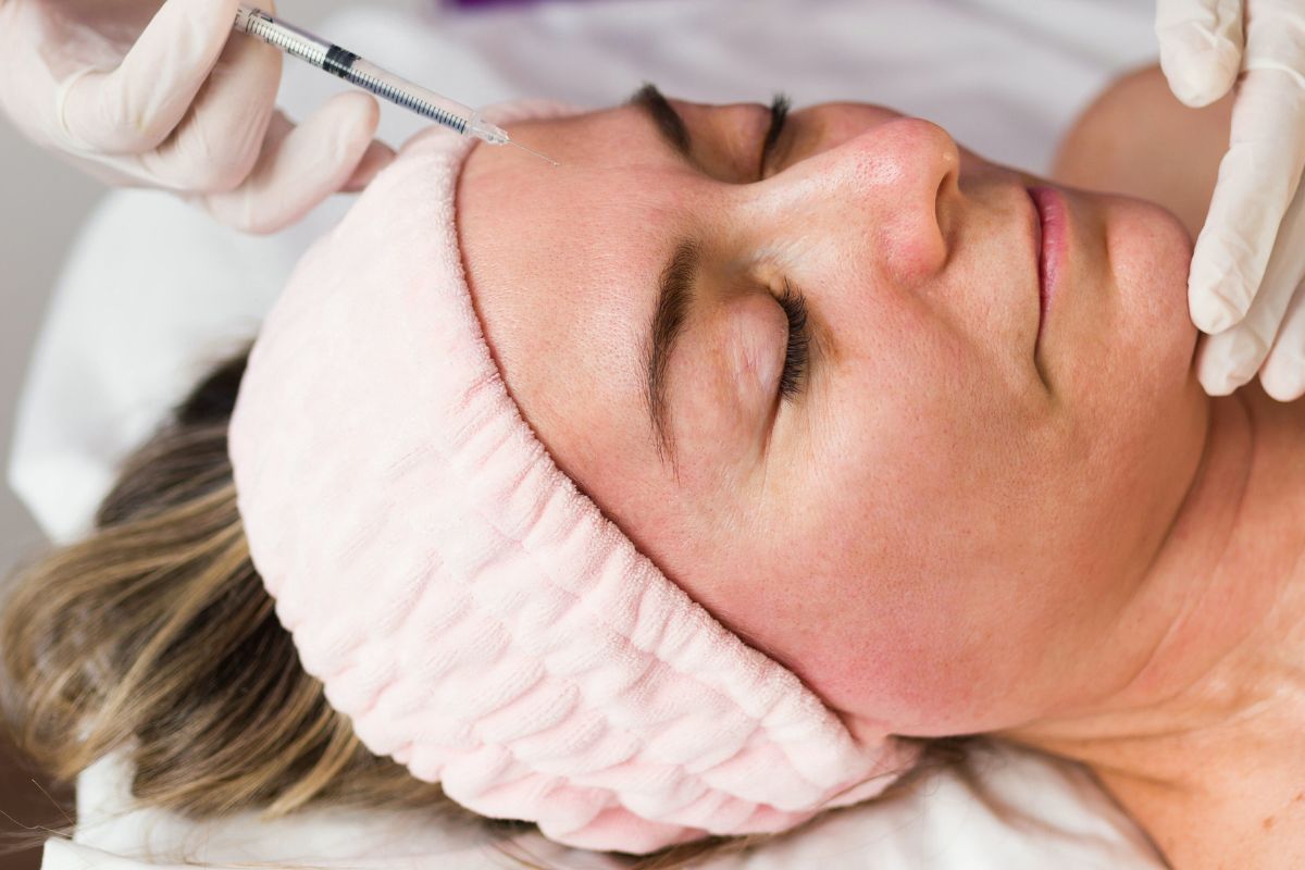 arrugas expresion con toxina botulínica